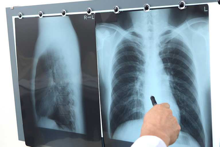 呼吸器専門医としてのスペシャリティー